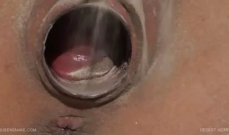 விளையாட்டு குறுகிய காட்சிகளை டாக்டர் குத சிகிச்சை